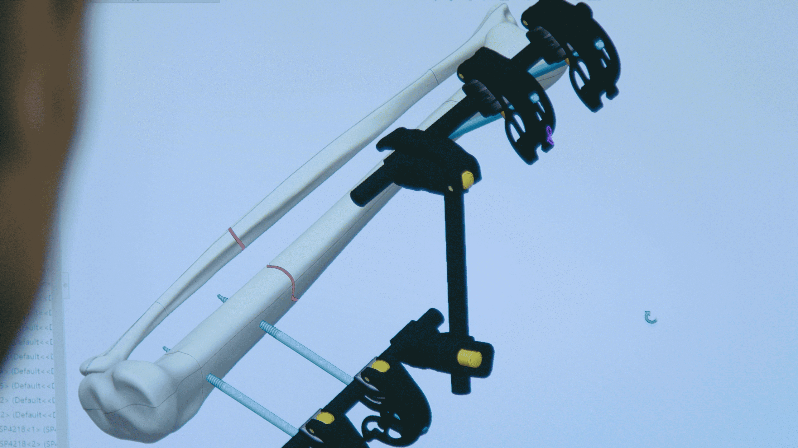 ARCHIMED MedTech sells orthopedic implants maker Citieffe to Poly Medicure, a leading global manufacturer of medical devices